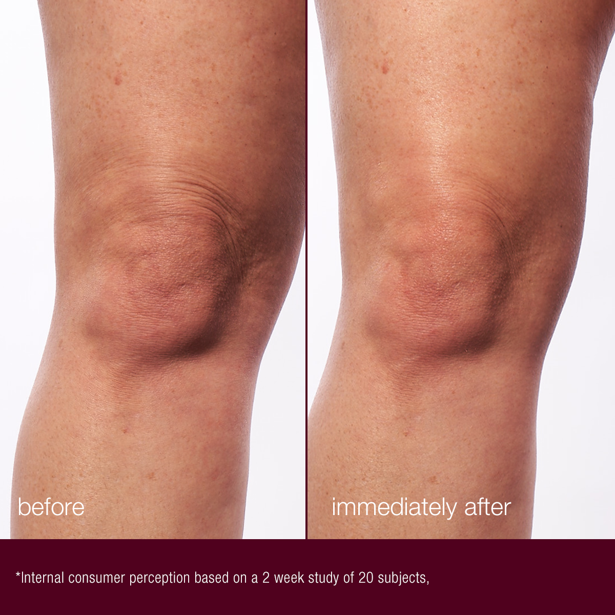 DynamicSkinSculptor-before_after on knee