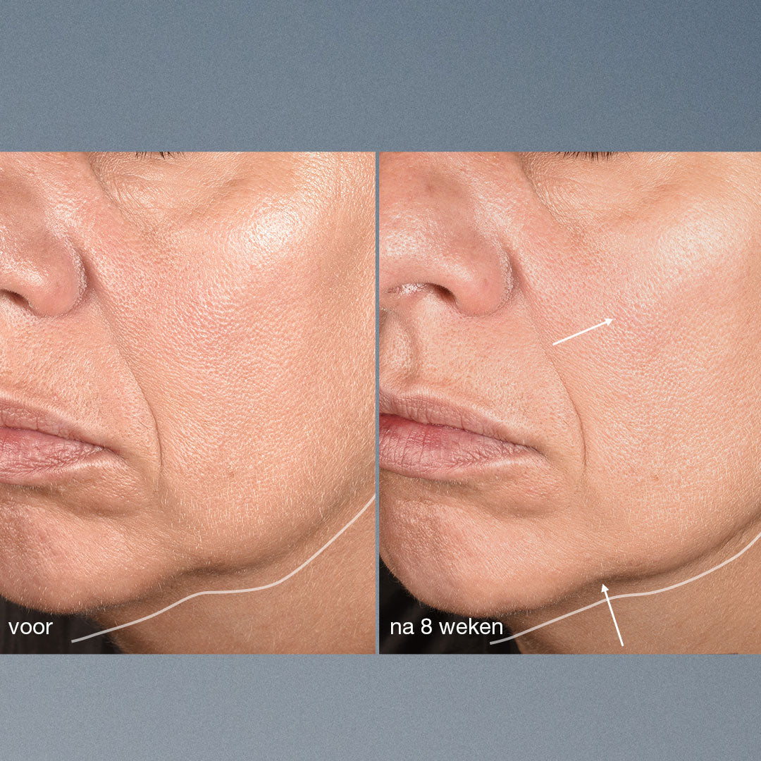 Neuro-Touch-Symmetry-Serum---B_A