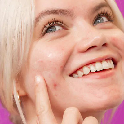 Post Breakout Fix skin quiz
