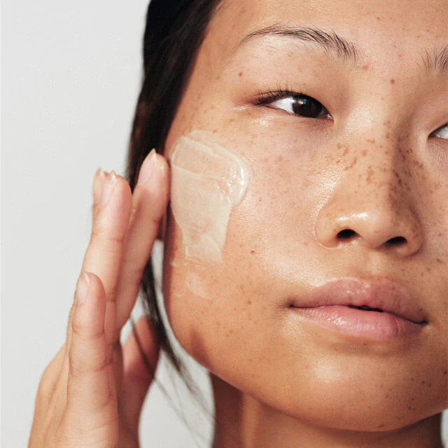 Alles wat je over pigmentvlekken moet weten