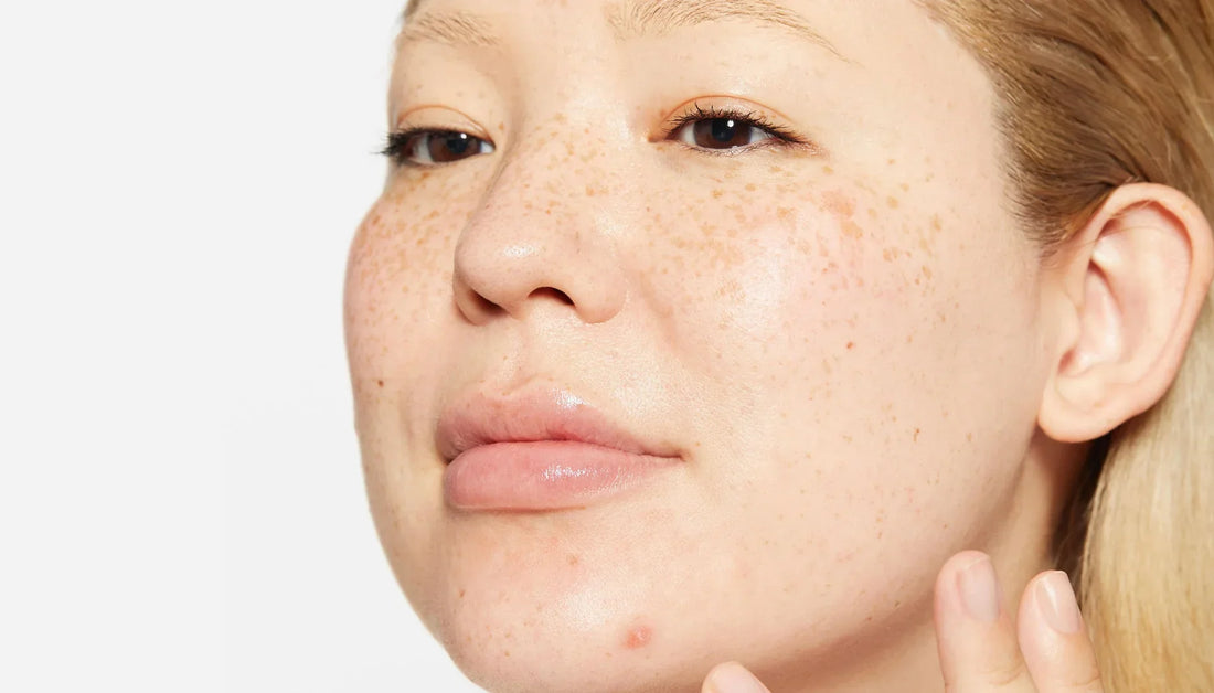 skincare tijdens zwangerschap