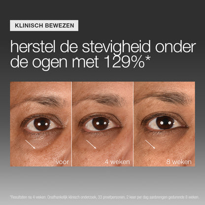 Smart Eye Density