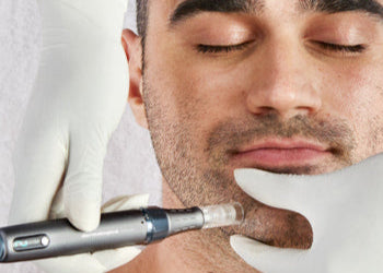 Microneedling