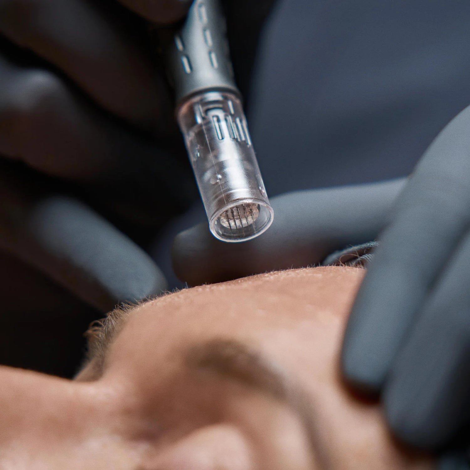 PRO-TREATMENTS-PAGE_PRO-MICRONEEDLING