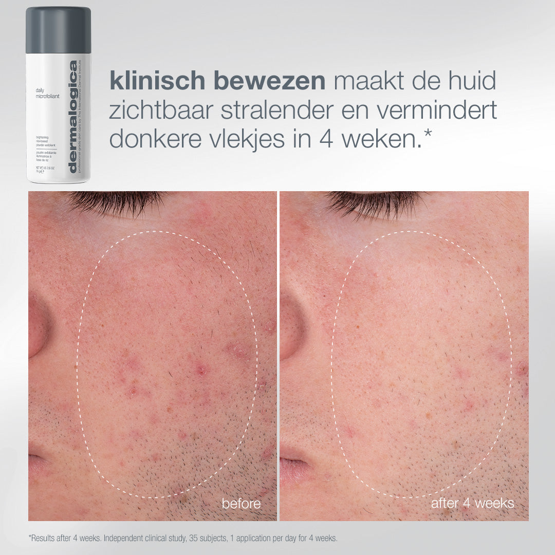 Daily Microfoliant: voor en na
