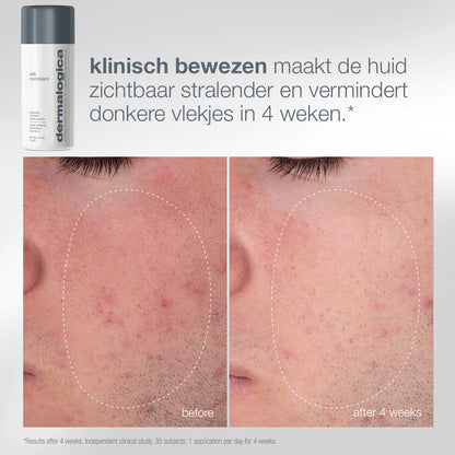 Daily Microfoliant: voor en na