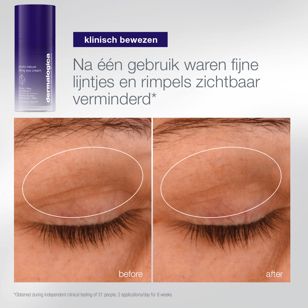 Phyto Nature Lifting Eye Cream: voor en na