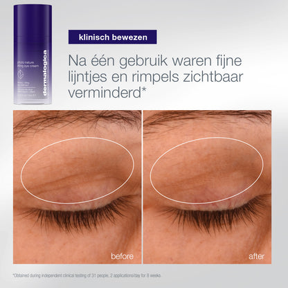 Phyto Nature Lifting Eye Cream: voor en na