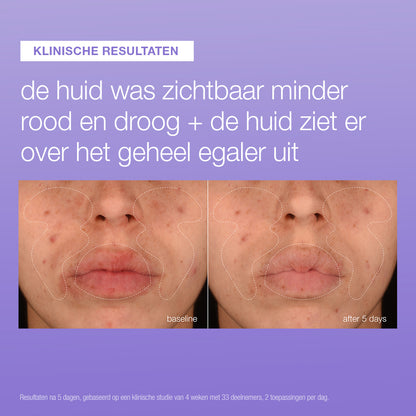 Voor en na 5 dagen Stabilizing Repair Serum: gezicht