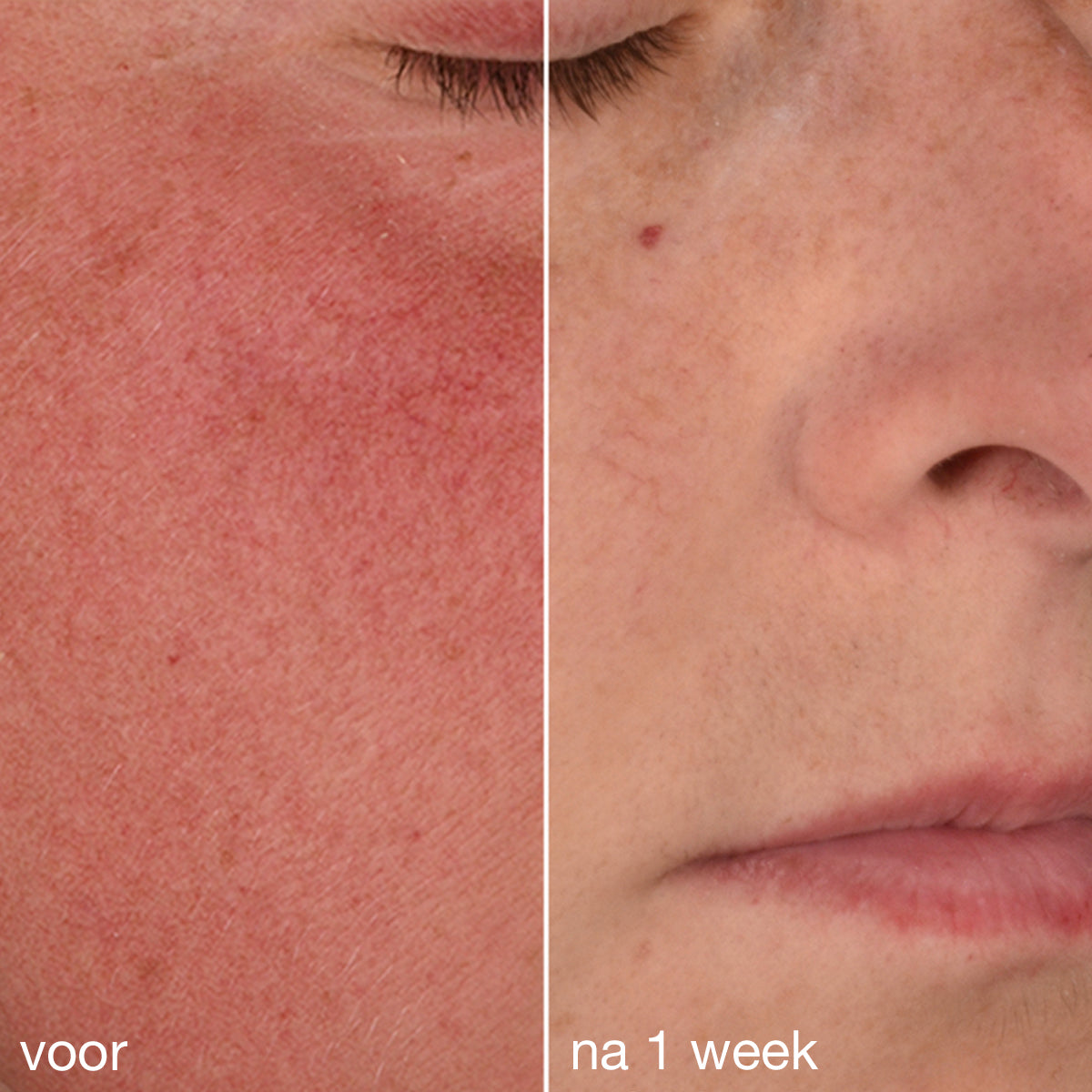 Stabilizing Repair Cream